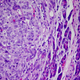 Illustration for article titled Cancer is just as deadly as it was 50 years ago. Heres why thats about to change.